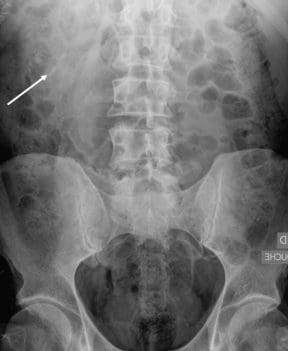 Uroscanner : examen, indications, préparation, durée, exécution, coûts